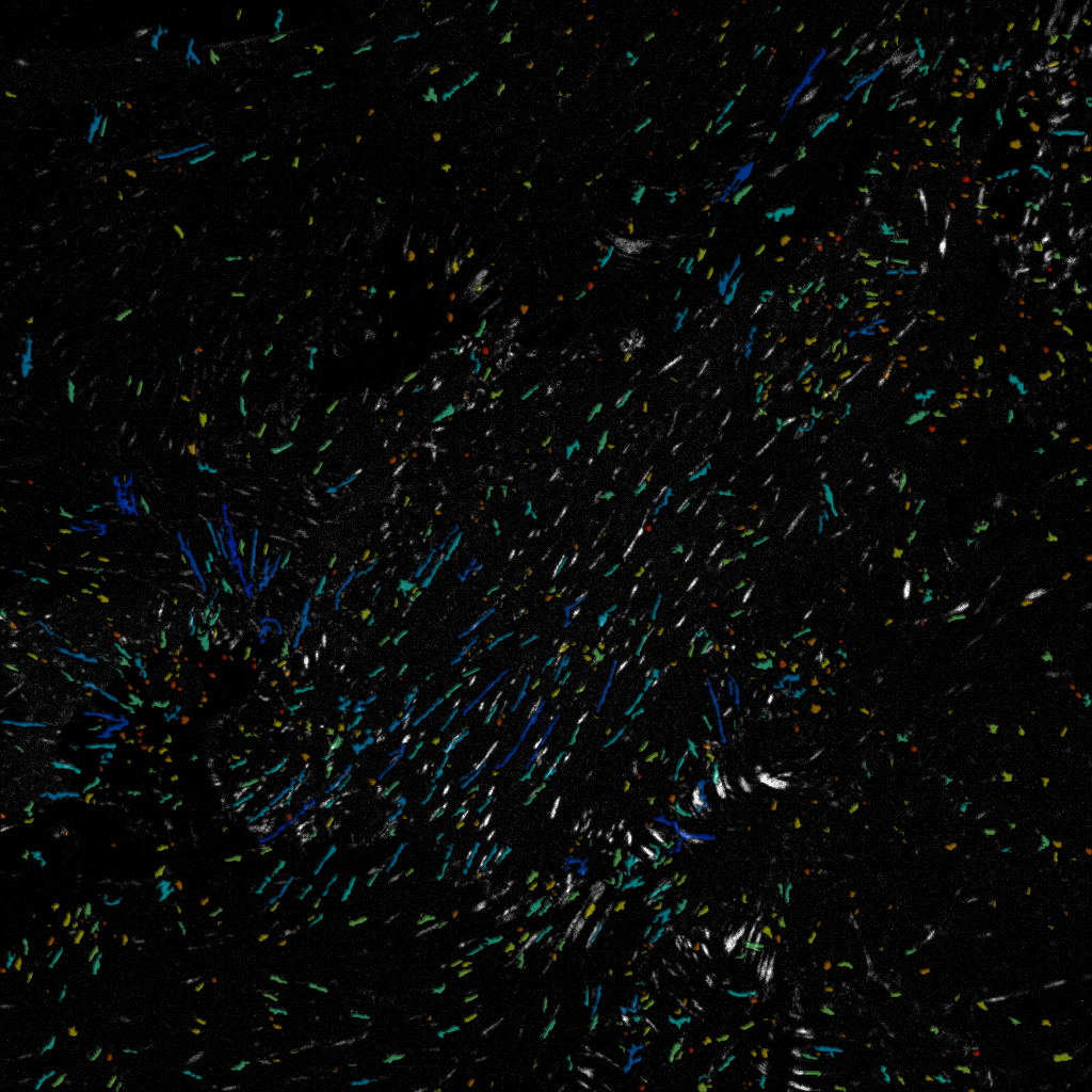 Tracking focal adhesions with TrackMate and Weka tutorial dataset 2
